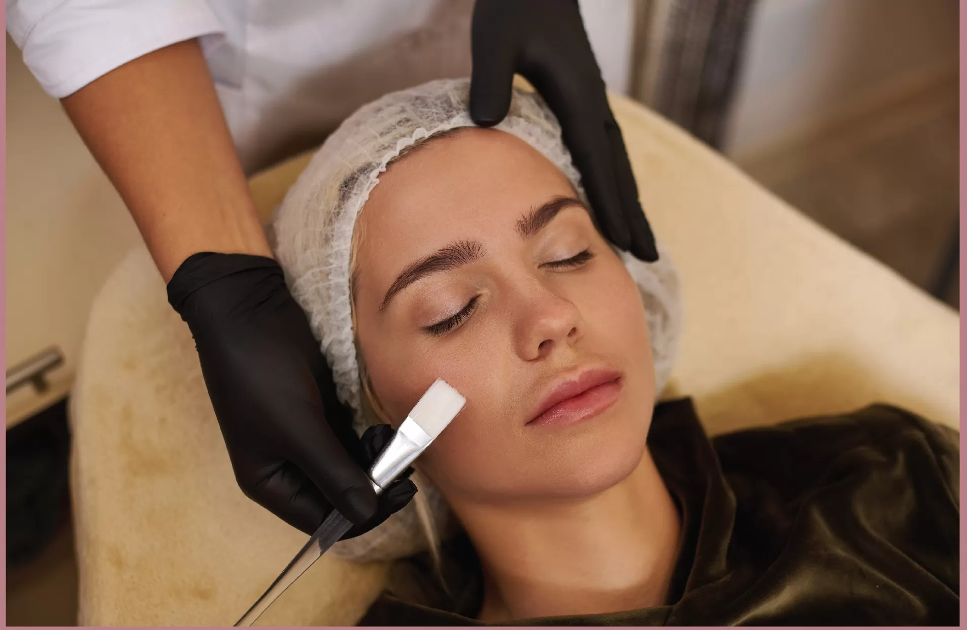 Woman having chemical peel