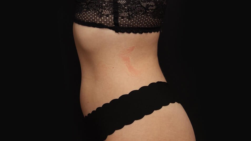 truBody_carousel_2_after