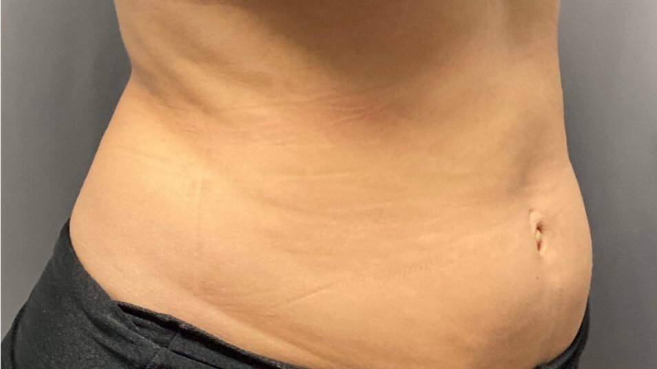 truBody_carousel_4_before truBody_carousel_4_before